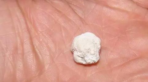 宠物乌龟结石该怎么办?(宠物乌龟结石的症状与治疗)